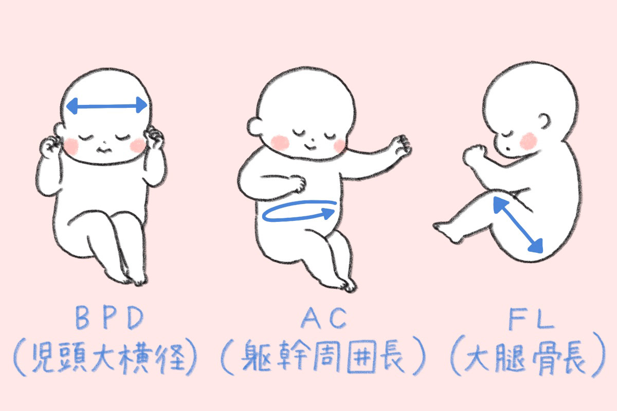 胎児 bpd 基準 値